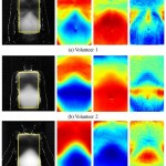 PCA Based Analysis of External Respiratory Motion Using an RGB-D Camera